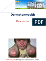 Dermatomyositis: Zhang Nian Nian