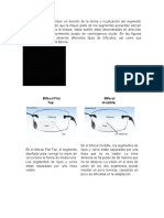 Bifocales Usados en El Mercado