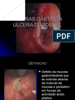 Ulcera gastrica y Duodenal..ppt