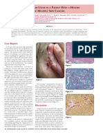 Skin Cancer Patient Ulcer Study by OC Skin Institute's Dr. Tony Nakhla