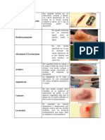 Heridas Incisas o Cortantes