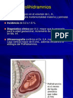 Polihidramnios PDF