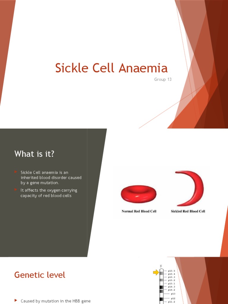 Understanding Sickle Cell Anaemia Basics | PDF | Wellness | Science ...