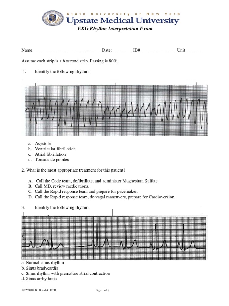 Ekg Test 1 Internal Medicine Cardiovascular System