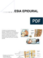 Anestesia Epidural