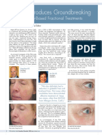 Syneron Introduces Groundbreaking: Radiofrequency-Based Fractional Treatments