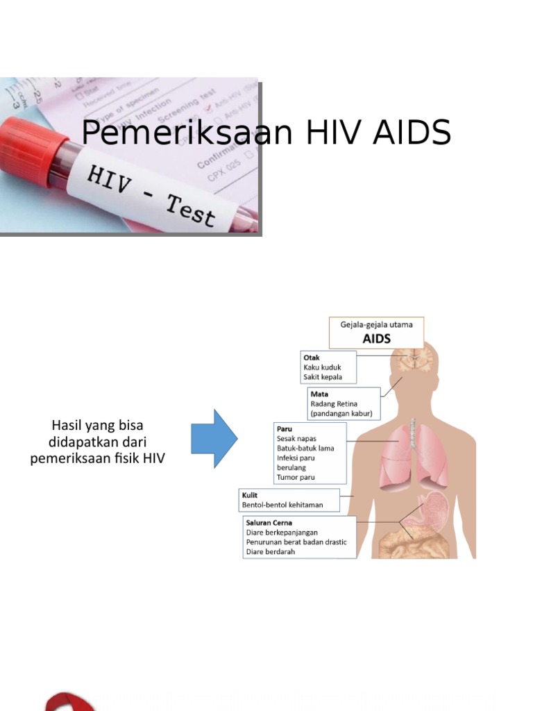 PEMERIKSAAN DIAGNOSTIK Hiv | PDF