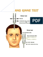 Weber and Rinne Test