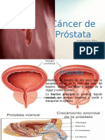 Cáncer de Próstata 