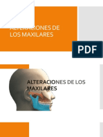 Alteraciones de Los Maxilares