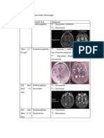 Gambaran MRI Pada Stroke Hemoragik