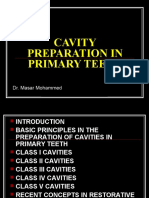 cavity preparation