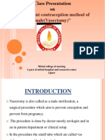 Permanent Contraception Method of Male (Vasectomy)