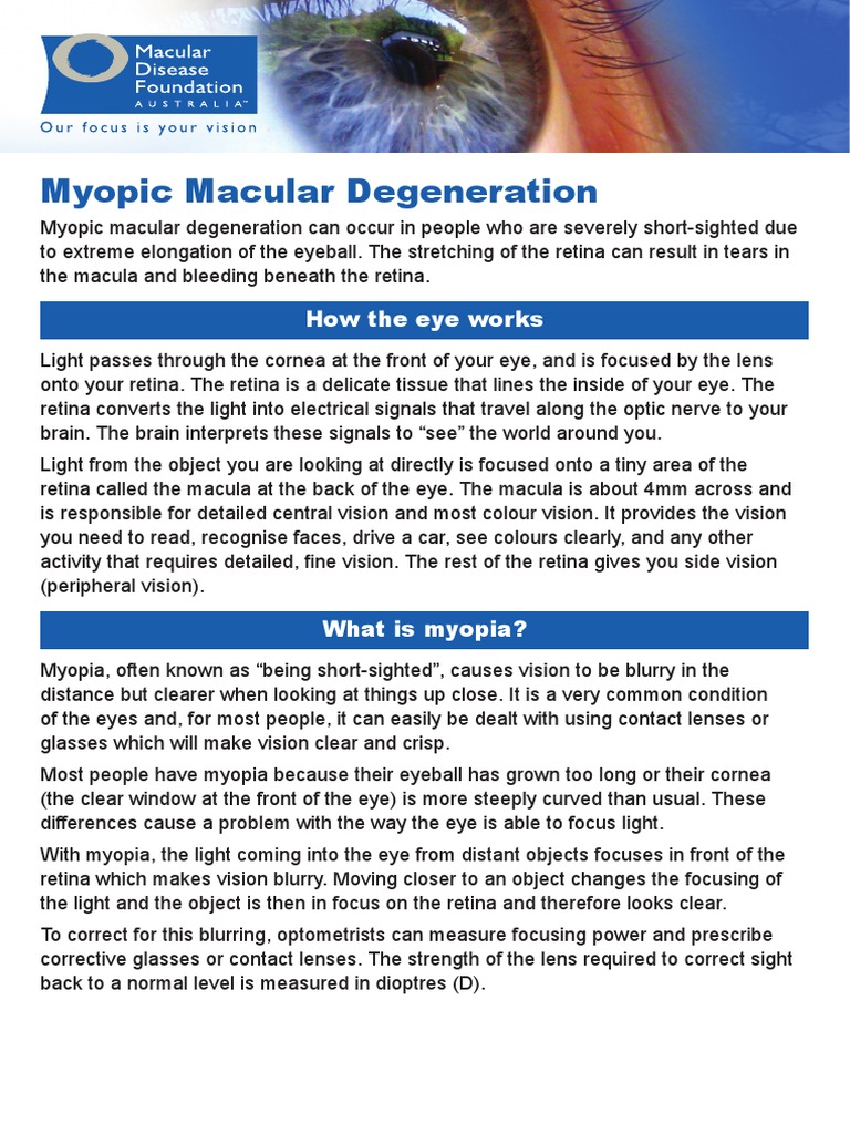 Understanding Myopic Macular Degeneration | PDF | Retina | Eye