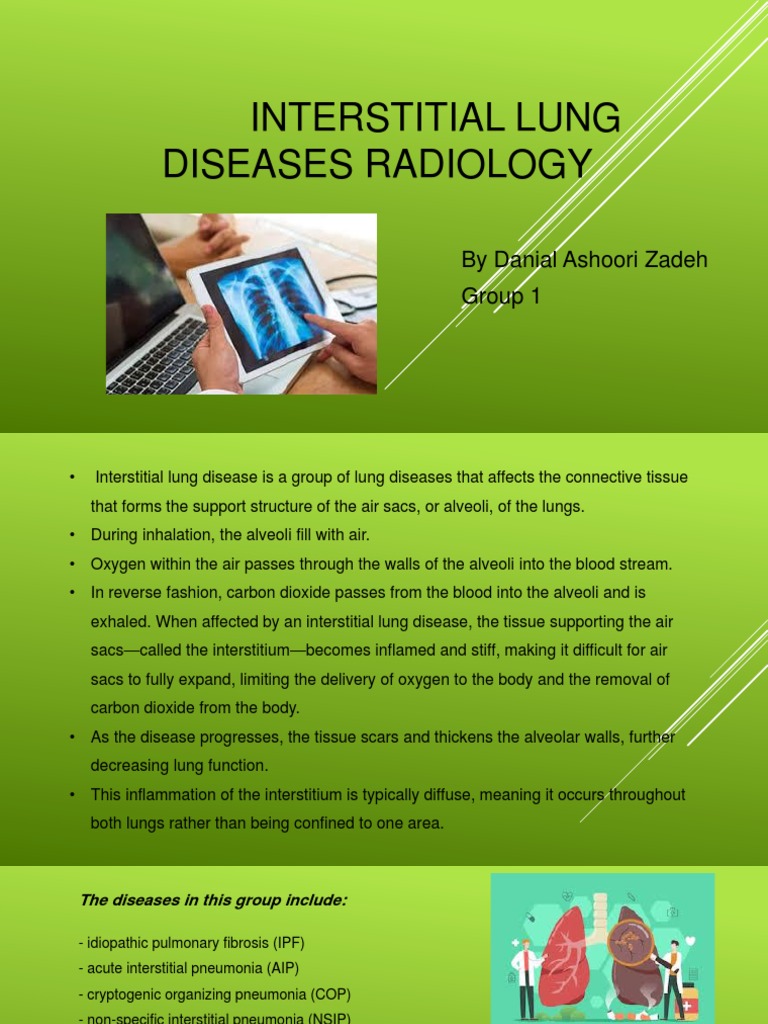Interstitial Lung Diseases Radiology 22222 | PDF | Lung | Ct Scan