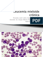 Leucemia Mieloide Crónica