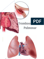 Tromboembolismo Pulmonar