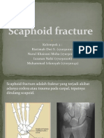 Fraktur Scaphoid