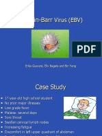 EBV Virus Causing Infectious Mononucleosis