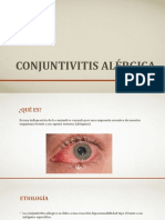 Conjuntivitis Alérgica