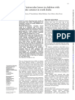 Use of Intraocular Lenses in Children With Traumatic Cataract in South India