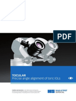 Tocular: Precise Angle Alignment of Toric Iols
