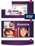 Anemia