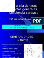 RX Torax Normal Insuficiencia Cardíaca y Valvulopatías Fin