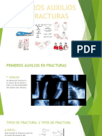 Diapositivas de Fracturas