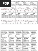 Right Heart Catheterization Guide | PDF | Diastole | Blood Pressure
