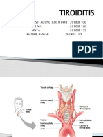 TIROIDITIS