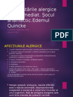 Socul Anafilactic, Edemul Quinke