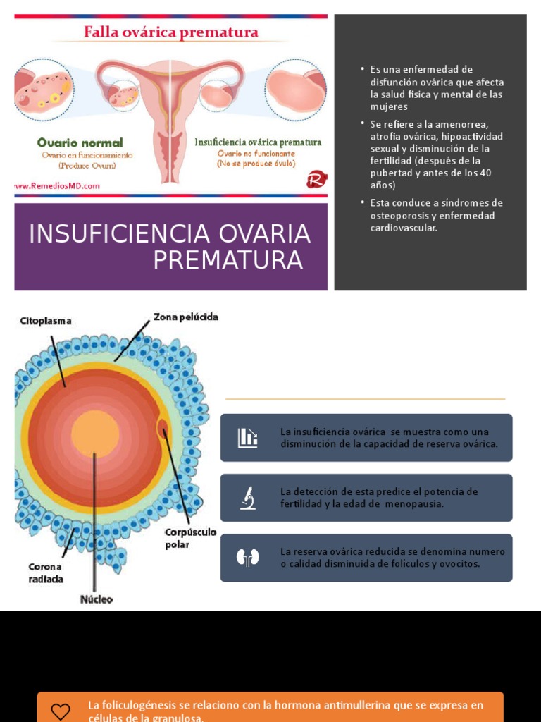 Insuficiencia Ovaria Prematura | PDF