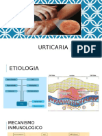 URTICARIA