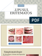 lupus.pptx