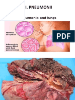 Pneumonii Bronsiectazii