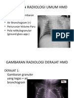 Dokumen - Tips - Gambaran Radiologi Umum HMD