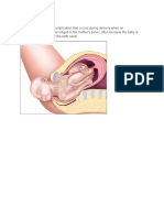 Shoulder Dystocia Is A Complication That Occurs During Delivery When An