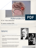 Adenoidectomie