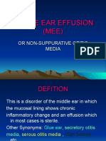 MIDDLE EAR EFFUSION GUIDE