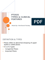 Ptosis Types & Clinical Features: Made By:-Amritansh Pandey