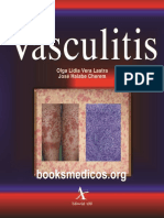 Vasculitis: causas, síntomas y tratamiento