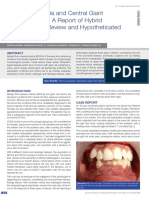 Fibrous Dysplasia and Central Giant Cell Granuloma A Report of Hybrid Lesion With Its Review and Hypotheticated Pathogenesis