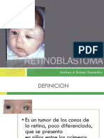 Retinoblastoma