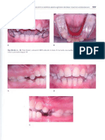 Ortodoncia en Dentición Mixta - Esgrivan_unlocked2 - 0549.pdf