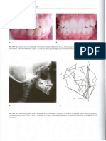 Ortodoncia en Dentición Mixta - Esgrivan_unlocked2 - 0542.pdf