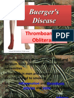 Buergers Disease Visual Aid