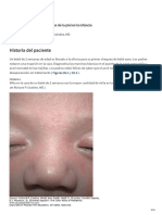 Cambios Normales de La Piel en La Infancia PDF