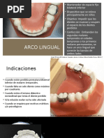 Mantenedores de Espacio: Corona y Banda Ansa | PDF | Odontología | Diente