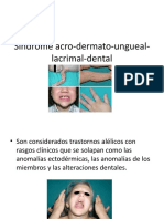Síndrome Acro-Dermato-Ungueal-Lacrimal-Dentaljeny